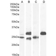 abx431676 (0.1 µg/ml) staining of Human (A), (0.03 µg/ml) Mouse (B), (0.1 µg/ml) Rat (C) and Pig (D) Heart lysate (35 µg protein in RIPA buffer). Detected by chemiluminescence.