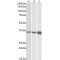 Fast Skeletal Muscle Troponin T (TNNT3) Antibody