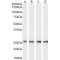 Triosephosphate isomerase Antibody