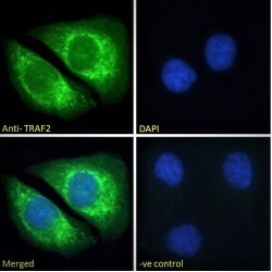 TNF Receptor Associated Factor 2 (TRAF2) Antibody