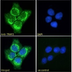 TNF Receptor Associated Factor 2 (TRAF2) Antibody