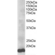 abx431690 staining (0.5 µg/ml) of HeLa lysate (RIPA buffer, 35 µg total protein per lane). Primary incubated for 1 hour. Detected by western blot using chemiluminescence.