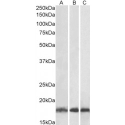 Ubiquitin-Conjugating Enzyme E2 L3 (UBE2L3) Antibody