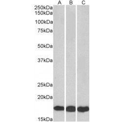 Ubiquitin-Conjugating Enzyme E2 L3 (UBE2L3) Antibody