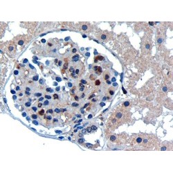 SUMO-Conjugating Enzyme UBC9 (UBE2I) Antibody