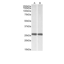 Ubiquitin Carboxyl Terminal Hydrolase L1 (UCHL1) Antibody