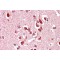 Netrin Receptor UNC5C (UNC5C) Antibody