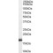 Von Hippel-Lindau Disease Tumor Suppressor (VHL) Antibody