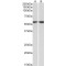 Vimentin (VIM) Antibody