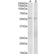 abx431706 (2 µg/ml) staining of Mouse (A) and Rat (B) Small Intestine lysate (35 µg protein in RIPA buffer). Primary incubation was 1 hour. Detected by chemiluminescence.