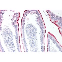 Vacuolar Protein Sorting-Associated Protein 45 (VPS45) Antibody