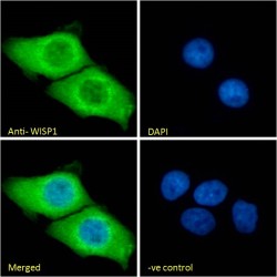 WNT1 Inducible Signaling Pathway Protein 1 / WISP1 (CCN4) Antibody