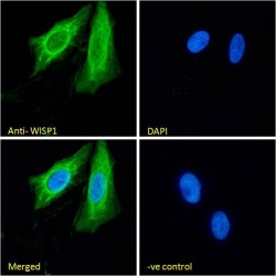 WNT1 Inducible Signaling Pathway Protein 1 / WISP1 (CCN4) Antibody