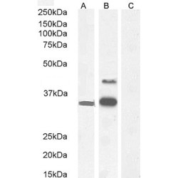 WNT1 Inducible Signaling Pathway Protein 1 / WISP1 (CCN4) Antibody