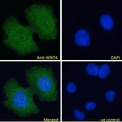 Protein Wnt-4 (WNT4) Antibody