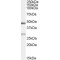 Vesicle Transport Protein SEC20 (BNIP1) Antibody