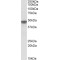 NADH Ubiquinone Oxidoreductase Core Subunit S2 (NDUFS2) Antibody