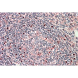 CTD Small Phosphatase Like Protein 1 (CTDSP1) Antibody