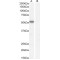 IKAROS Family Zinc Finger 4 (IKZF4) Antibody