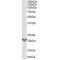 TGFB Induced Factor Homeobox 2 (TGIF2) Antibody