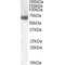 Glucokinase Regulatory Protein (GCKR) Antibody