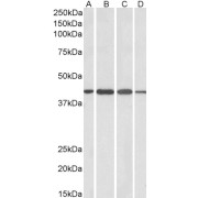 abx431755 (1 µg/ml) staining of Human Cerebellum (A), Mouse (B), Rat (C) and Pig (D) Brain lysates (35 µg protein in RIPA buffer). Primary incubation was 1 hour. Detected by chemiluminescence.