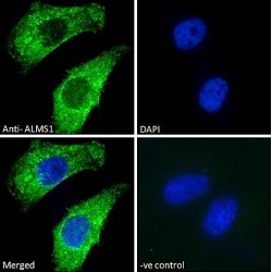 Alstrom Syndrome Protein 1 (ALMS1) Antibody