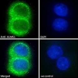 Alstrom Syndrome Protein 1 (ALMS1) Antibody
