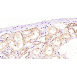 NADPH Oxidase 1 (NOX1) Antibody