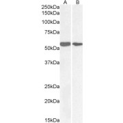 abx431770 (0.1 µg/ml) staining of lysate of cell line colorectal adenocarcinoma (A) and HeLa (B) (35 µg protein in RIPA buffer). Detected by chemiluminescence.