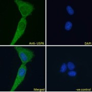 abx431774 Immunofluorescence analysis of paraformaldehyde fixed A431 cells, permeabilized with 0.15% Triton. Primary incubation 1hr (10 µg/ml) followed by AF488 secondary antibody (2 µg/ml), showing cytoplasmic/vesicle staining. The nuclear stain is DAPI (blue). Negative control: Unimmunized goat IgG (10 µg/ml) followed by AF488 secondary antibody (2 µg/ml).