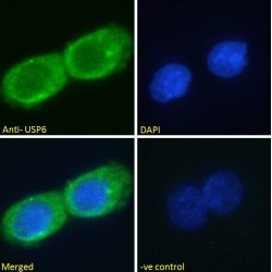 Ubiquitin Carboxyl-Terminal Hydrolase 6 (USP6) Antibody