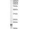 Anterior Gradient Protein 2 (AGR2) Antibody