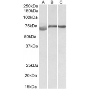 abx431780 (1 µg/ml) staining of Human (A), Mouse (B) and Rat (C) Testis lysate (35 µg protein in RIPA buffer). Primary incubation was 1 hour. Detected by chemiluminescence.