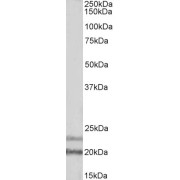 abx431785 (1 µg/ml) staining of Human Frontal Cortex lysate (35 µg protein in RIPA buffer). Primary incubation was 1 hour. Detected by chemiluminescence.