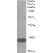 abx431791 (1 µg/ml) staining of A549 lysate (35 µg protein in RIPA buffer). Detected by chemiluminescence.