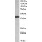 Poly(RC) Binding Protein 1 (PCBP1) Antibody