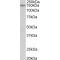 Synaptic Ras GTPase Activating Protein 1 (SYNGAP1) Antibody