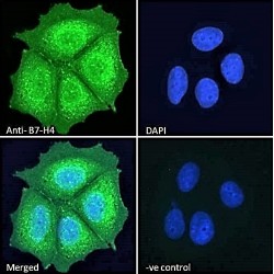 B7 Homolog 4 (B7-H4) Antibody