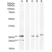 abx431808 (1 µg/ml) staining of HEK293 iso 1 + iso 2 cell lysate (A) + peptide (B). Human Adrenal Gland iso 1 (C), Human Adrenal Gland iso 2 (D) and (0.1 µg/ml) Human pancreas iso 1 (E) lysate (35 µg protein in RIPA buffer). Detected by chemiluminescence.