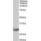 V-Set Domain-Containing T-Cell Activation Inhibitor 1 (VTCN1) Antibody