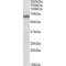 Fragile X Mental Retardation 1 (FMR1) Antibody