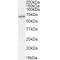 Sodium/Glucose Cotransporter 1 (SLC5A1) Antibody