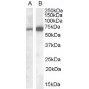 Staining of Human Brain (Cerebellum) lysate (35 µg protein in RIPA buffer). A) abx431833 (0.1 µg/ml) and B) abx432437 (0.05 µg/ml). Primary incubation was 1 hour. Detected by chemiluminescence.