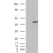 Estrogen-Related Receptor Gamma (ESRRG) Antibody