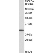 abx431841 (1 µg/ml) staining of K562 cell lysate (35 µg protein in RIPA buffer). Primary incubation was 1 hour. Detected by chemiluminescence.