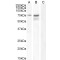 Neurochondrin (NCDN) Antibody