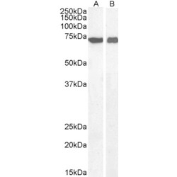 Apoptosis Inducing Factor 1, Mitochondrial (AIFM1) Antibody