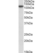 abx431865 (0.1 µg/ml) staining of Human Cerebellum lysate (35 µg protein in RIPA buffer). Detected by chemiluminescence.