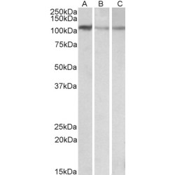 Monofunctional C1-Tetrahydrofolate Synthase, Mitochondrial (MTHFD1L) Antibody